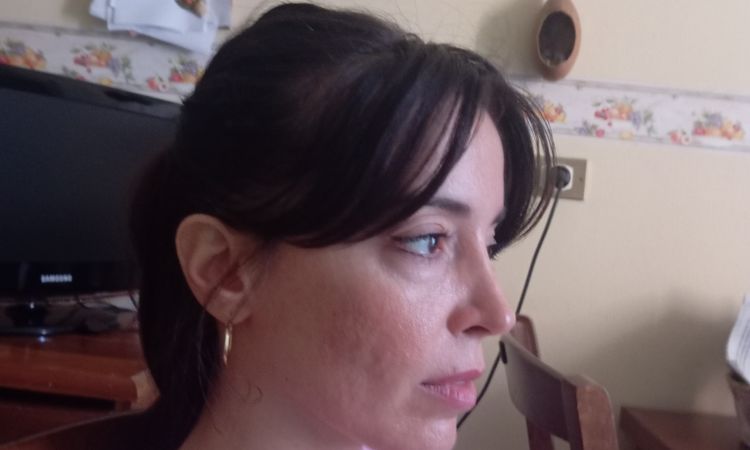 Problema profhilo sul viso - 82460