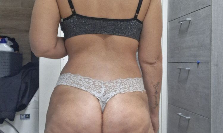 45 giorni post liposuzione glutei svuotati - 83051