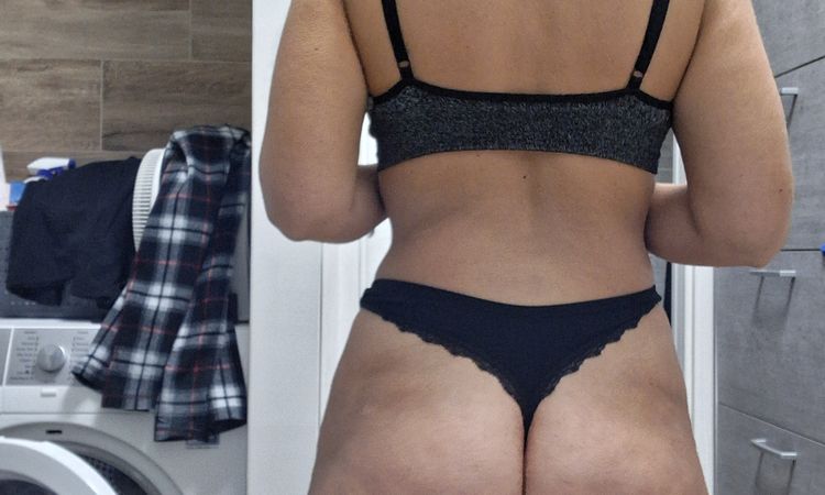 45 giorni post liposuzione glutei svuotati - 83052