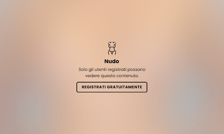 Buco dovuto a rimozione neo con laser su zigomo - 83139