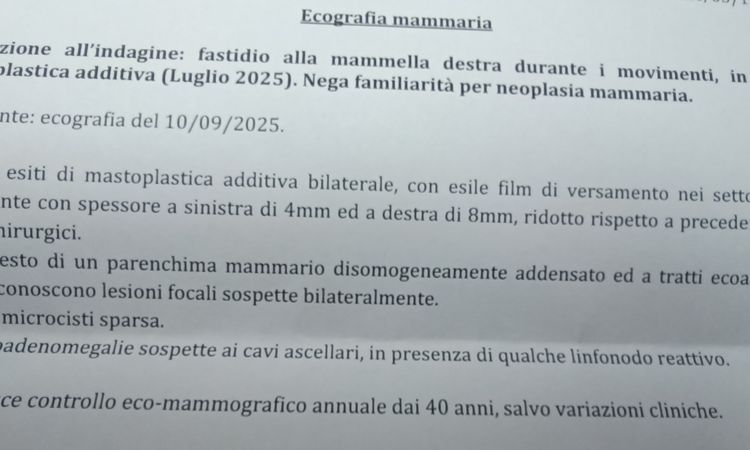 Intervento mastoplastica sottomuscolo post 5 mesi - 83198