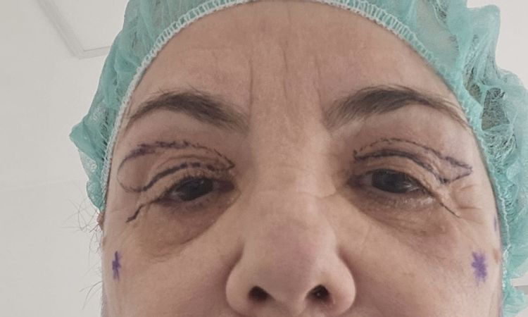 Occhi con aspetto cadente verso il basso - 83444