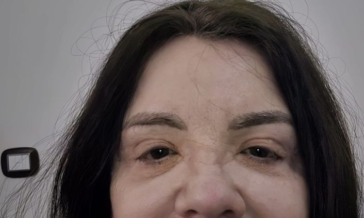 Occhi con aspetto cadente verso il basso - 83445