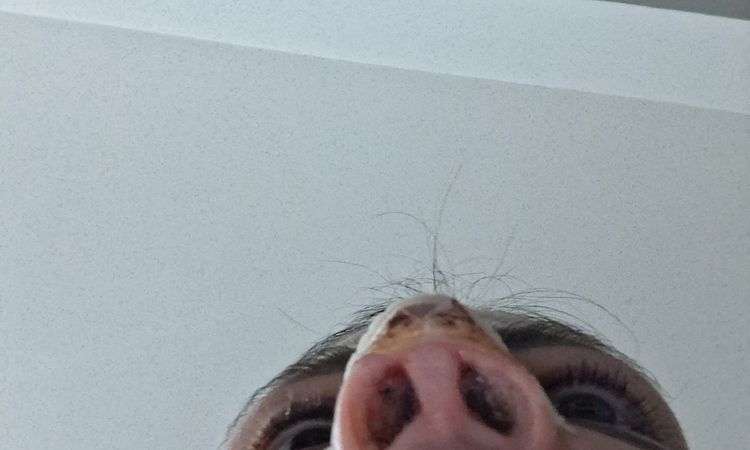 2 giorni post rinoplastica - 83637