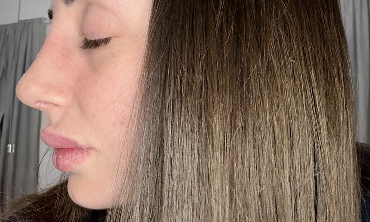 dubbi sulla deviazione ancora presente e sul dorso ancora largo - 83912