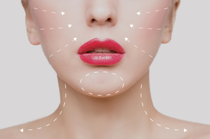 Risultati di un trattamento anti rughe