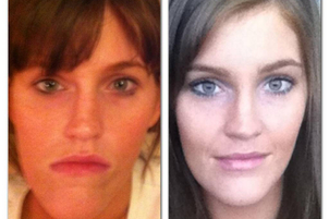 Esempio di asimmetria del volto