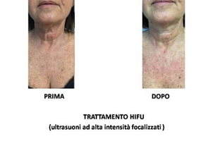 Immagine ceduta dalla Dott.ssa Elena Rametti