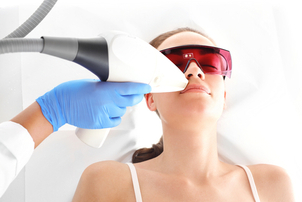 funzionamento del laser co2