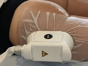 Apparecchiatura per cool sculpting