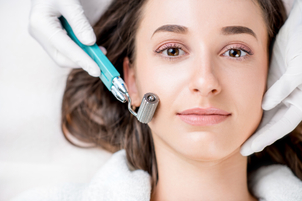 Microneedling usi e benefici