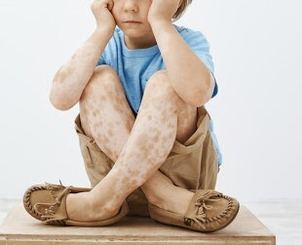 Chi è più a rischio?