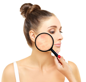 A chi è rivolta la microdermoabrasione?