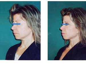Risultati prima e dopo