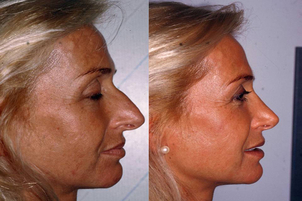 Risultati prima e dopo