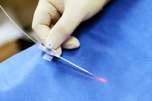 laser anti couperose