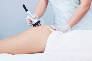 Trattamenti anti cellulite efficaci