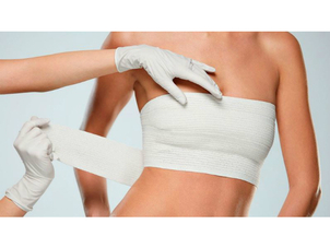 Mastopessi post intervento