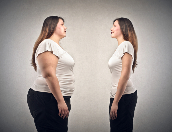 Palloncino gastrico e obesità