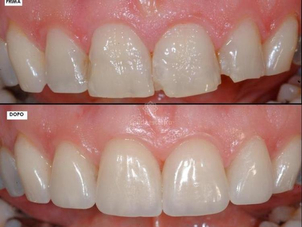 RIsultati estetica dentale