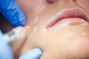 Come fare filler acido ialuronico