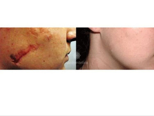 Immagine ceduta dal Dott. Alessandro Covacivich