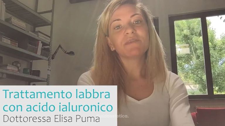 Filler labbra - Dr.ssa Elisa Puma