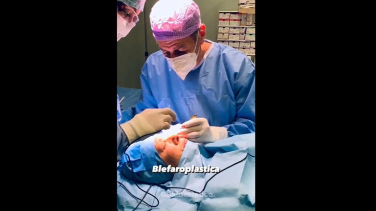 Blefaroplastica - Dott. Riccardo Lucchesi