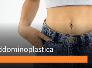 L´addominoplastica in chirurgia estetica || Dr Montemurro - Chirurgo Plastico