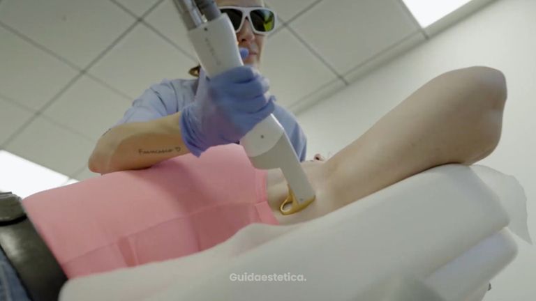 Depilazione laser - 7even clinic