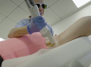 Depilazione laser - 7even clinic