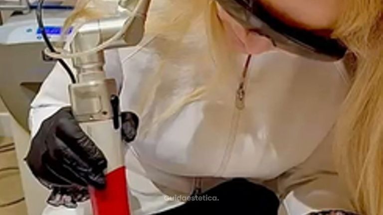 Dott.ssa Cornelia Florea Eliminazione di tatuaggio con tecnologia Q-Switch
