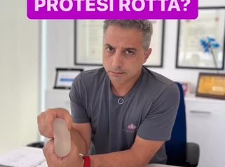 Protesi rota - Dr Antonio Tambuscio