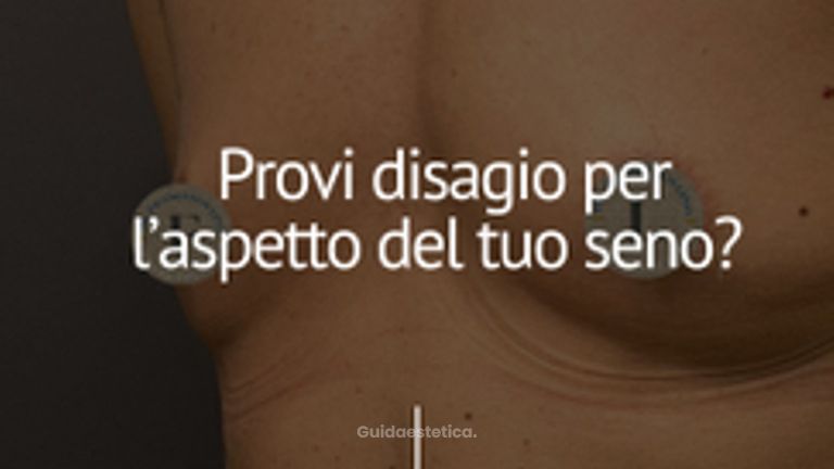 Dott. Francesco Lino & Medfarmitalia Team Mastoplastica additiva ascellare