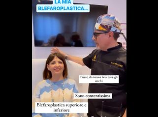 Blefaroplastica - Dott. Bellone Donato