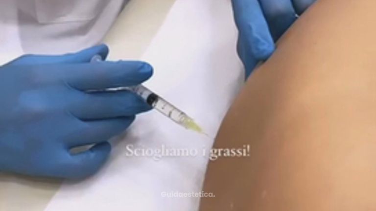 Liposuzione non Chirurgica