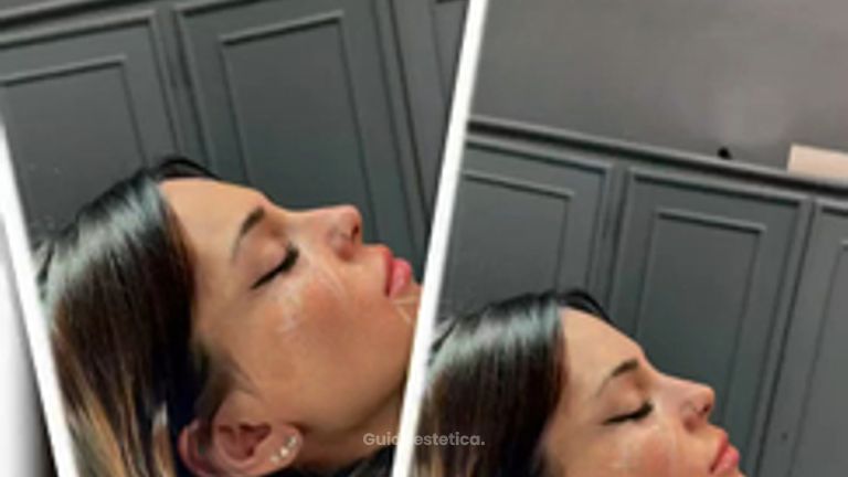 Prof. Dott. Massimiliano Giuliano MaxLift