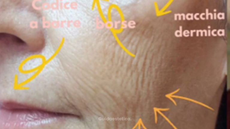 Dr.ssa Alessia Capozzi Full face trattamento combinato
