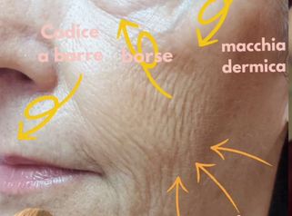 Dr.ssa Alessia Capozzi Full face trattamento combinato