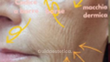 Dr.ssa Alessia Capozzi Full face trattamento combinato