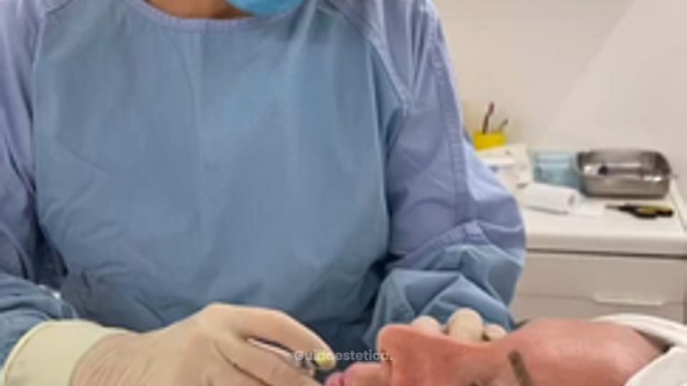 Dott.ssa Silvia Scevola rigenerazione dal proprio tessuto adiposo
