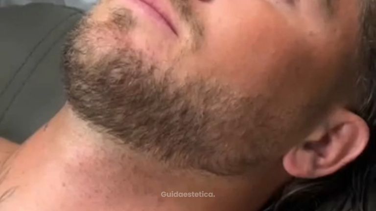 Faceland Botox adatto anche agli uomini