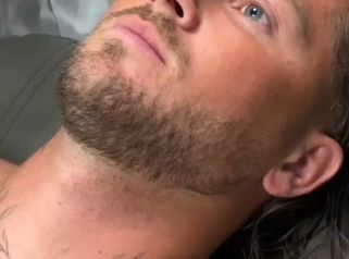 Faceland Botox adatto anche agli uomini