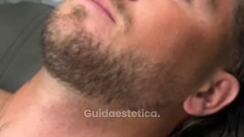 Faceland Botox adatto anche agli uomini