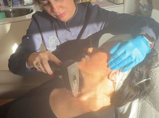 Studio Medico Ametìs Dott.ssa Elena Vescovi Rassodamento del mento con Morpheus 8