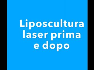Liposcultura - Dott. Giovanni Gallo