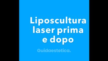 Liposcultura - Dott. Giovanni Gallo