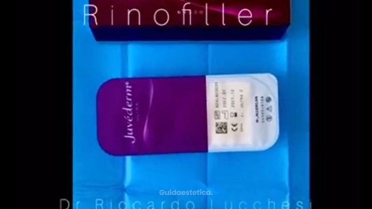 Rinofiller - Dott. Riccardo Lucchesi