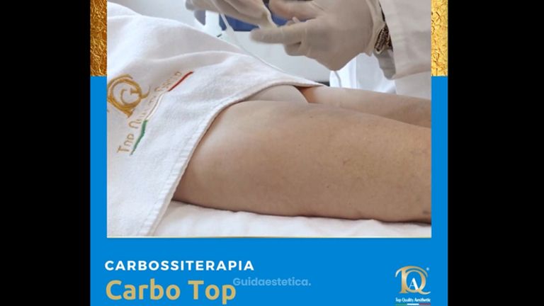 Carbossiterapia - Dott. Ruggero Sinigaglia