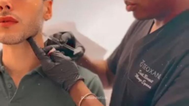 Venini Ventitre Medical Center Filler mandibolare uomo per definire l’ovale del viso